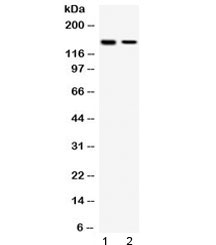 SAFB1 / SAFB Antibody - Western blot testing of human 1) HeLa and 2) MCF7 cell lysate with SAFB antibody at 0.5ug/ml. Predicted molecular weight: ~103 kDa but routinley observed at ~150 kDa.