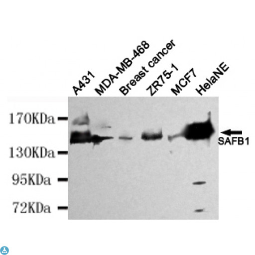 SAFB1 / SAFB Antibody - Western blot detection of SAFB1 in HelaNE, A431, MDA-MB-468, Breast cancer, ZR75-1 and MCF7 cell lysates using SAFB1 mouse mAb (1:4000 diluted). Predicted band size: 130kDa. Observed band size: 130kDa.