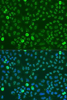 SAFB1 / SAFB Antibody - Immunofluorescence analysis of U2OS cells using SAFB Polyclonal Antibody at dilution of 1:100.Blue: DAPI for nuclear staining.