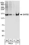 SAFB2 Antibody - Detection of Human SAFB2 by Western Blot. Samples: Whole cell lysate from HeLa (5, 15 and 50 ug for WB) and 293T (T; 50 ug) cells. Antibody: Affinity purified rabbit anti-SAFB2 antibody used for WB at 0.04 ug/ml. Detection: Chemiluminescence with an exposure time of 10 seconds.