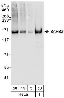 SAFB2 Antibody - Detection of Human SAFB2 by Western Blot. Samples: Whole cell lysate from HeLa (5, 15 and 50 ug for WB) and 293T (T; 50 ug) cells. Antibody: Affinity purified rabbit anti-SAFB2 antibody used for WB at 0.04 ug/ml. Detection: Chemiluminescence with an exposure time of 10 seconds.