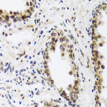 SAFB2 Antibody - Immunohistochemistry of paraffin-embedded human prostate.