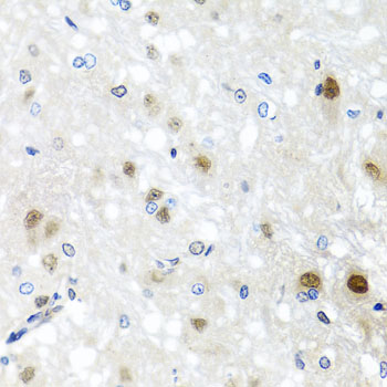 SAFB2 Antibody - Immunohistochemistry of paraffin-embedded rat brain tissue.