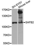 SAFB2 Antibody - Western blot analysis of extracts of various cell lines, using SAFB2 antibody at 1:1000 dilution. The secondary antibody used was an HRP Goat Anti-Rabbit IgG (H+L) at 1:10000 dilution. Lysates were loaded 25ug per lane and 3% nonfat dry milk in TBST was used for blocking. An ECL Kit was used for detection and the exposure time was 30s.