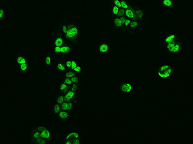 SAFB2 Antibody - Immunofluorescence staining of SAFB2 in MCF7 cells. Cells were fixed with 4% PFA, permeabilzed with 0.1% Triton X-100 in PBS, blocked with 10% serum, and incubated with rabbit anti-Human SAFB2 polyclonal antibody (dilution ratio 1:200) at 4°C overnight. Then cells were stained with the Alexa Fluor 488-conjugated Goat Anti-rabbit IgG secondary antibody (green). Positive staining was localized to Nucleus.