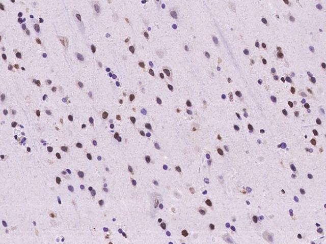 SAFB2 Antibody - Immunochemical staining of human SAFB2 in human brain with rabbit polyclonal antibody at 1:100 dilution, formalin-fixed paraffin embedded sections.