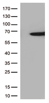 SAG / Arrestin Antibody - HEK293T cells were transfected with the pCMV6-ENTRY control. (Left lane) or pCMV6-ENTRY SAG. (Right lane) cDNA for 48 hrs and lysed