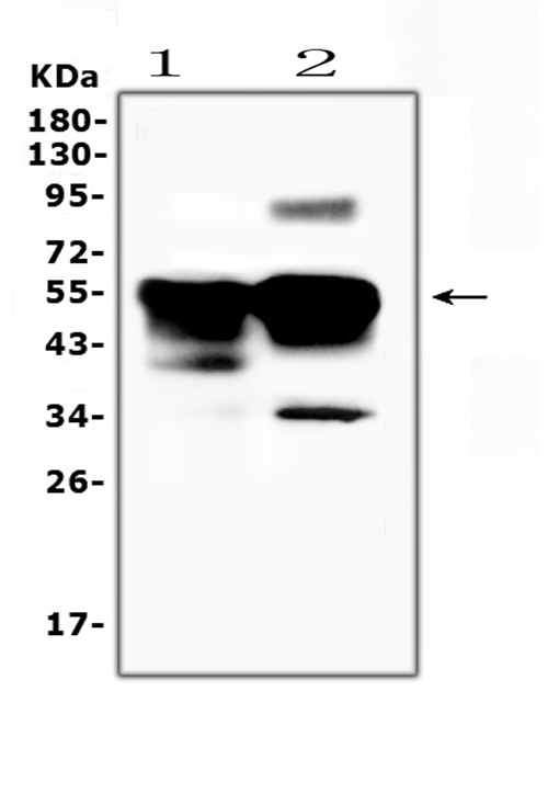 SAG / Arrestin Antibody - Western blot analysis of Retinal S antigen using anti-Retinal S antigen antibody. Electrophoresis was performed on a 5-20% SDS-PAGE gel at 70V (Stacking gel) / 90V (Resolving gel) for 2-3 hours. The sample well of each lane was loaded with 50ug of sample under reducing conditions. Lane 1: rat eye ball tissue lysates,Lane 2: mouse eye ball tissue lysates. After Electrophoresis, proteins were transferred to a Nitrocellulose membrane at 150mA for 50-90 minutes. Blocked the membrane with 5% Non-fat Milk/ TBS for 1.5 hour at RT. The membrane was incubated with rabbit anti-Retinal S antigen antigen affinity purified polyclonal antibody at 0.5 ug/mL overnight at 4?, then washed with TBS-0.1% Tween 3 times with 5 minutes each and probed with a goat anti-rabbit IgG-HRP secondary antibody at a dilution of 1:10000 for 1.5 hour at RT. The signal is developed using an Enhanced Chemiluminescent detection (ECL) kit with Tanon 5200 system. A specific band was detected for Retinal S antigen at approximately 45-55KD. The expected band size for Retinal S antigen is at 45KD.