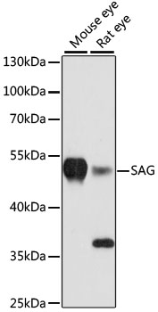 SAG / Arrestin Antibody - Western blot analysis of extracts of various cell lines, using SAG antibody at 1:3000 dilution. The secondary antibody used was an HRP Goat Anti-Rabbit IgG (H+L) at 1:10000 dilution. Lysates were loaded 25ug per lane and 3% nonfat dry milk in TBST was used for blocking. An ECL Kit was used for detection and the exposure time was 90s.
