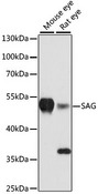 SAG / Arrestin Antibody - Western blot analysis of extracts of various cell lines, using SAG antibody at 1:3000 dilution. The secondary antibody used was an HRP Goat Anti-Rabbit IgG (H+L) at 1:10000 dilution. Lysates were loaded 25ug per lane and 3% nonfat dry milk in TBST was used for blocking. An ECL Kit was used for detection and the exposure time was 90s.