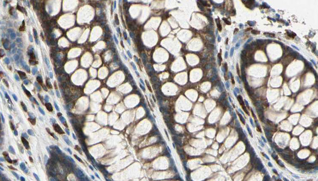 SAG / Arrestin Antibody - 1:100 staining rat colon tissue by IHC-P. The sample was formaldehyde fixed and a heat mediated antigen retrieval step in citrate buffer was performed. The sample was then blocked and incubated with the antibody for 1.5 hours at 22°C. An HRP conjugated goat anti-rabbit antibody was used as the secondary.