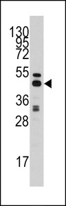 SAHH / AHCY Antibody - Western blot of anti-AHCY Antibody in HepG2 cell line lysates (35 ug/lane). AHCY(arrow) was detected using the purified antibody.