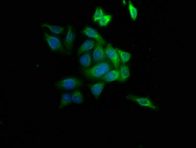 SAHH / AHCY Antibody - Immunofluorescence staining of HepG2 cells with AHCY Antibody at 1:233, counter-stained with DAPI. The cells were fixed in 4% formaldehyde, permeabilized using 0.2% Triton X-100 and blocked in 10% normal Goat Serum. The cells were then incubated with the antibody overnight at 4°C. The secondary antibody was Alexa Fluor 488-congugated AffiniPure Goat Anti-Rabbit IgG(H+L).