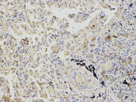 SAHH / AHCY Antibody - Immunohistochemistry of paraffin-embedded human lung using AHCY antibody at dilution of 1:200 (200x lens).