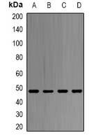 SAHH / AHCY Antibody - Western blot analysis of SAHH expression in HepG2 (A); MCF7 (B); K562 (C); mouse liver (D) whole cell lysates.