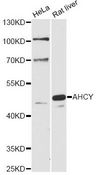 SAHH / AHCY Antibody - Western blot analysis of extracts of various cell lines, using AHCY antibody at 1:1000 dilution. The secondary antibody used was an HRP Goat Anti-Rabbit IgG (H+L) at 1:10000 dilution. Lysates were loaded 25ug per lane and 3% nonfat dry milk in TBST was used for blocking. An ECL Kit was used for detection and the exposure time was 90s.