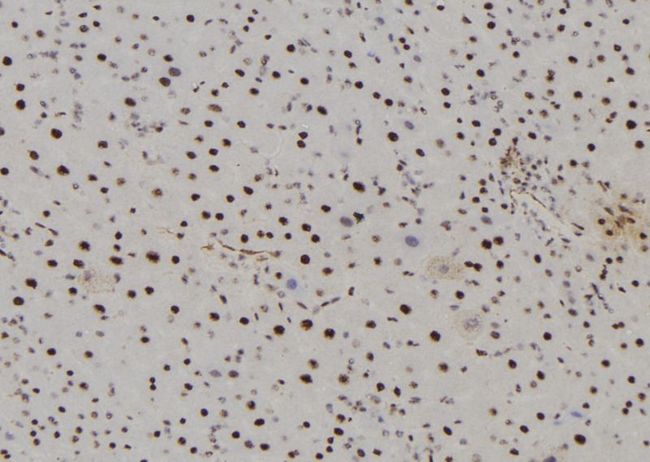 SAHH / AHCY Antibody - 1:100 staining mouse liver tissue by IHC-P. The sample was formaldehyde fixed and a heat mediated antigen retrieval step in citrate buffer was performed. The sample was then blocked and incubated with the antibody for 1.5 hours at 22°C. An HRP conjugated goat anti-rabbit antibody was used as the secondary.