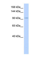 SALL3 Antibody - SALL3 antibody Western blot of Placenta lysate. This image was taken for the unconjugated form of this product. Other forms have not been tested.