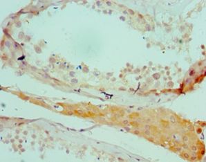 SALL4 Antibody - Immunohistochemistry of paraffin-embedded human testicle using antibody at 1:100 dilution.