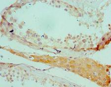 SALL4 Antibody - Immunohistochemistry of paraffin-embedded human testicle using antibody at 1:100 dilution.