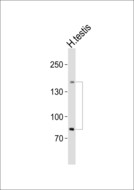 SALL4 Antibody - Western blot of lysate from human testis tissue lysate, using SALL4 antibody diluted at 1:1000. A goat anti-rabbit IgG H&L (HRP) at 1:10000 dilution was used as the secondary antibody. Lysate at 20 ug.