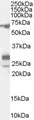 SALL4 Antibody - Antibody (0.1 ug/ml) staining of Rat Testis lysate (35 ug protein in RIPA buffer). Primary incubation was 1 hour. Detected by chemiluminescence.