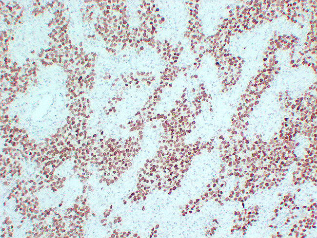 SALL4 Antibody - Seminoma 1