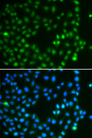 SALL4 Antibody - Immunofluorescence analysis of A549 cells.