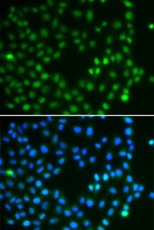SALL4 Antibody - Immunofluorescence analysis of A549 cells.