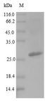 hupB Protein - (Tris-Glycine gel) Discontinuous SDS-PAGE (reduced) with 5% enrichment gel and 15% separation gel.