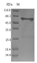 ompS1 Protein - (Tris-Glycine gel) Discontinuous SDS-PAGE (reduced) with 5% enrichment gel and 15% separation gel.