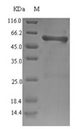 ompS1 Protein - (Tris-Glycine gel) Discontinuous SDS-PAGE (reduced) with 5% enrichment gel and 15% separation gel.