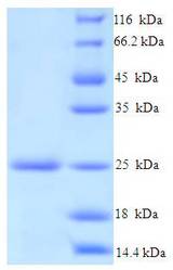 PrgI Protein