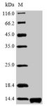prgJ Protein - (Tris-Glycine gel) Discontinuous SDS-PAGE (reduced) with 5% enrichment gel and 15% separation gel.