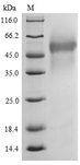 prgJ Protein - (Tris-Glycine gel) Discontinuous SDS-PAGE (reduced) with 5% enrichment gel and 15% separation gel.
