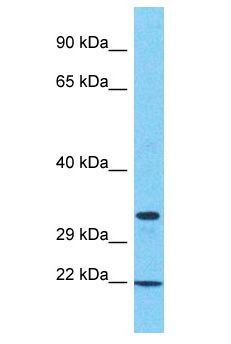 SAMD10 Antibody - SAMD10 antibody Western Blot of 786-0. Antibody dilution: 1 ug/ml.  This image was taken for the unconjugated form of this product. Other forms have not been tested.