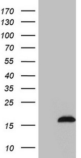 SAMD12 Antibody - HEK293T cells were transfected with the pCMV6-ENTRY control. (Left lane) or pCMV6-ENTRY SAMD12. (Right lane) cDNA for 48 hrs and lysed. Equivalent amounts of cell lysates. (5 ug per lane) were separated by SDS-PAGE and immunoblotted with anti-SAMD12. (1:2000)