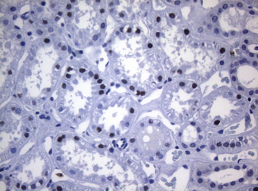 SAMD12 Antibody - Immunohistochemical staining of paraffin-embedded Human Kidney tissue within the normal limits using anti-SAMD12 mouse monoclonal antibody. (Heat-induced epitope retrieval by 1mM EDTA in 10mM Tris buffer. (pH8.5) at 120°C for 3 min. (1:150)