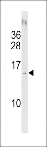 SAMD13 Antibody - SAMD13 Antibody western blot of NCI-H292 cell line lysates (35 ug/lane). The SAMD13 antibody detected the SAMD13 protein (arrow).