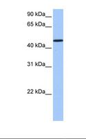 SAMD14 Antibody - Jurkat cell lysate. Antibody concentration: 1.0 ug/ml. Gel concentration: 12%.  This image was taken for the unconjugated form of this product. Other forms have not been tested.