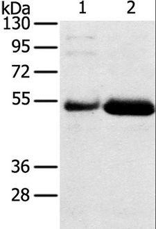 SAMD3 Antibody - Western blot analysis of Human placenta and stomach cancer tissue, using SAMD3 Polyclonal Antibody at dilution of 1:400.