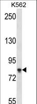 SAMD4B Antibody - SAMD4B Antibody western blot of K562 cell line lysates (35 ug/lane). The SAMD4B antibody detected the SAMD4B protein (arrow).