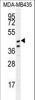 SAMD7 Antibody - SAMD7 Antibody western blot of MDA-MB435 cell line lysates (35 ug/lane). The SAMD7 antibody detected the SAMD7 protein (arrow).