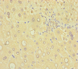 SAMD7 Antibody - Immunohistochemistry of paraffin-embedded human liver tissue using SAMD7 Antibody at dilution of 1:100