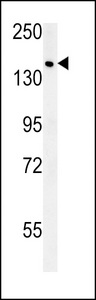 SAMD9 Antibody - SAMD9 Antibody western blot of MCF-7 cell line lysates (15 ug/lane). The SAMD9 antibody detected the SAMD9 protein (arrow).