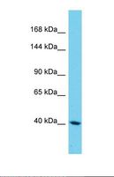 SAMD9L Antibody - Western blot of Human HepG2. SAMD9L antibody dilution 1.0 ug/ml.  This image was taken for the unconjugated form of this product. Other forms have not been tested.