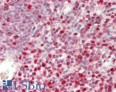 SAMHD1 Antibody - Human Tonsil: Formalin-Fixed, Paraffin-Embedded (FFPE)