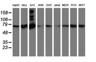 SAMHD1 Antibody - Western blot of extracts (35 ug) from 9 different cell lines by using g anti-SAMHD1 monoclonal antibody (HepG2: human; HeLa: human; SVT2: mouse; A549: human; COS7: monkey; Jurkat: human; MDCK: canine; PC12: rat; MCF7: human).