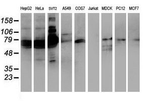 SAMHD1 Antibody - Western blot of extracts (35 ug) from 9 different cell lines by using anti-SAMHD1 monoclonal antibody.