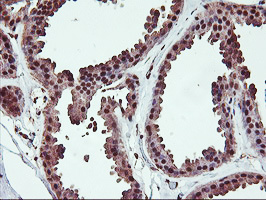 SAMHD1 Antibody - IHC of paraffin-embedded Human breast tissue using anti-SAMHD1 mouse monoclonal antibody.